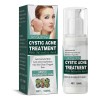 Jay Cystic Acne Tratamiento Para Eliminar Espinillas Barros Momento De