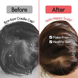 SplashEZ Cradle Cap Brush for Babies | Soothing Newborn Head Massager | Food-Grade Soft Silicone Baby Bath Brush & Scalp Scrubber | Infant Cradle Cap Comb - Organic Shape & Ladybug Design, 2-Pack