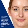 CeraVe Advanced Repair Ointment With Hyaluronic Acid and 3 Essential