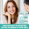 UpdateClassic Smile Line Patches, Anti-Wrinkle Face Patches to Smooth Fine