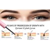 Dortanni Eyelash Growth Serum for Longer, Thicker Lashes