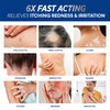Hermon Folliculitis Cream: Effective for Folliculitis Scalp Face and Body