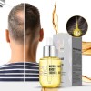 P Suero Natural Para El Crecimiento Del Cabello Para
