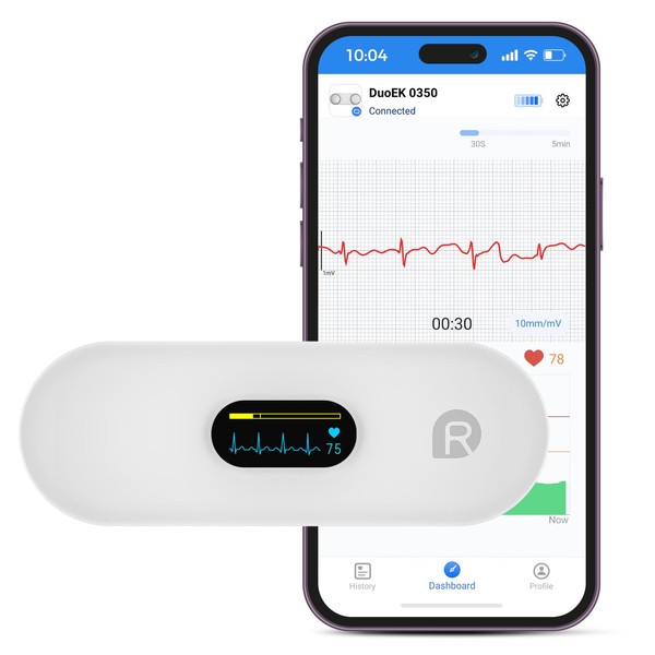 OVIIN Portable Heart Rate Monitor, Wireless Home Use Heart Rhythm Tracker, Heart Monitoring Devices,Smartphone App Compatible with iOS/Android