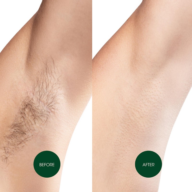 Nad's Hair Removal Body Wax Strips for Normal Skin, Body