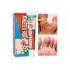 Tratamiento P Hongos Pies Comezon Sudor Olor Resequedad 20g