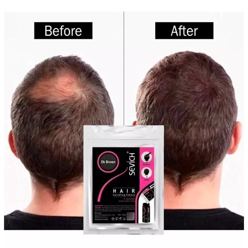 Universo en Linea Sevich Micro Fibras Naturales 100g Sustituto Cabello