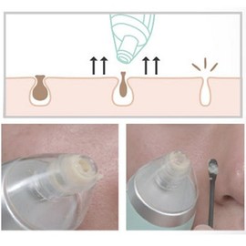 Cledbel Kill Pore Sebum Blackhead Pore Management Pore Device / 끌레드벨 킬포어 피지 블랙헤드 모공관리 모공기기