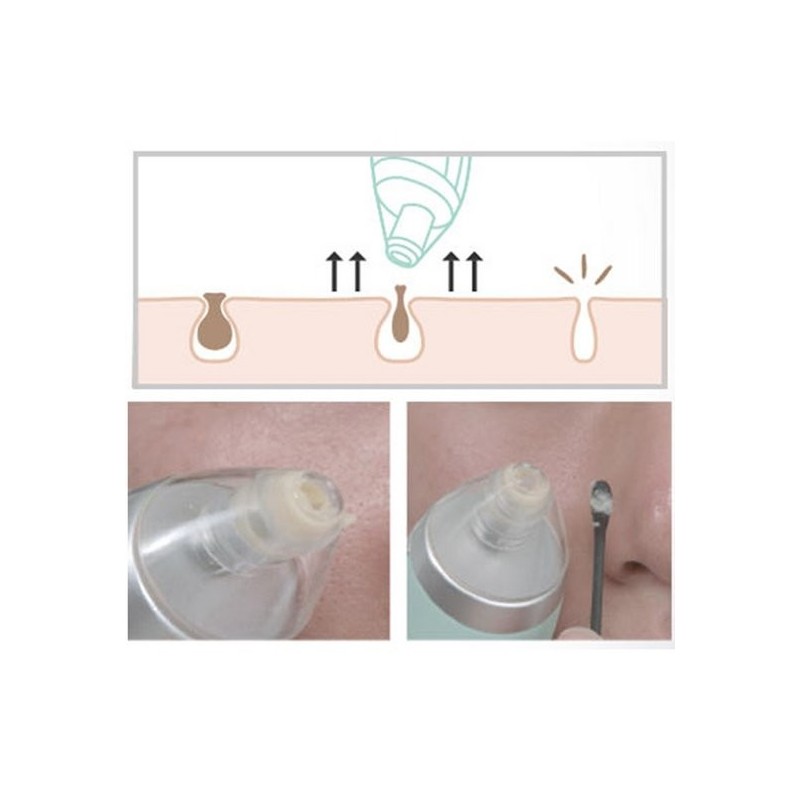Cledbel Kill Pore Sebum Blackhead Pore Management Pore Device /