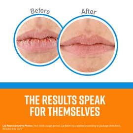 O'Keeffe's Cooling Lip Repair Lip Balm for Dry, Cracked Lips, Stick