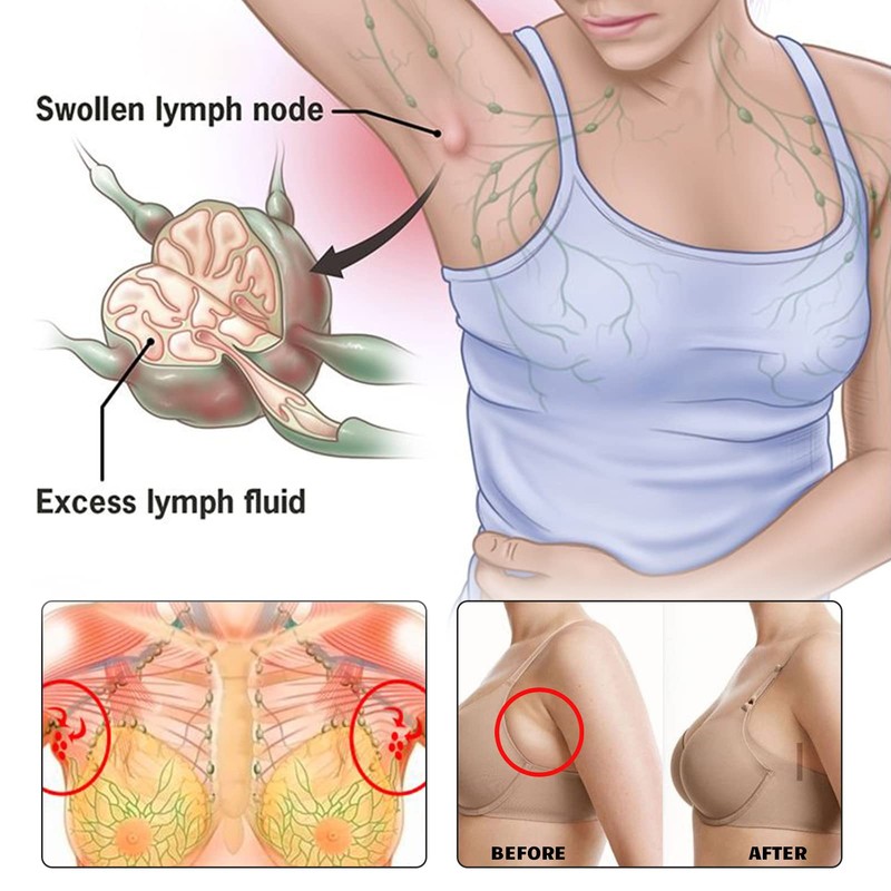 BXQJRJ Lymphatic Drainage Patch (12)