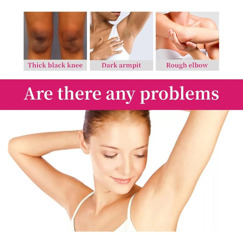 Crema Blanqueadora Para Partes Intimas, Aclarador De Axilas