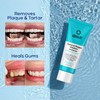 Plaque & Tartar Remover Toothpaste for Teeth: Removes Plaque &