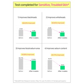 BRING GREEN Zinc Teca™ 1.2% BLEMISH SERUM | Mild Serum providing Soothing effect to Troubled Skin, Improves Blemish and Skin Pigmentation in 3 Days 0.85 Fl. Oz., 25ml