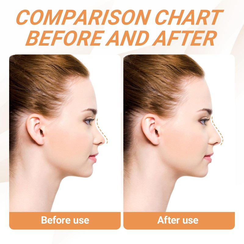 5 Pcs Nose Lifter - Nose Shaper Clip ＆ Instant