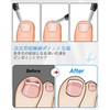 Tisojpod Nail Clipper, Nail Clipper, For Winding Nails, Double V-Shaped,