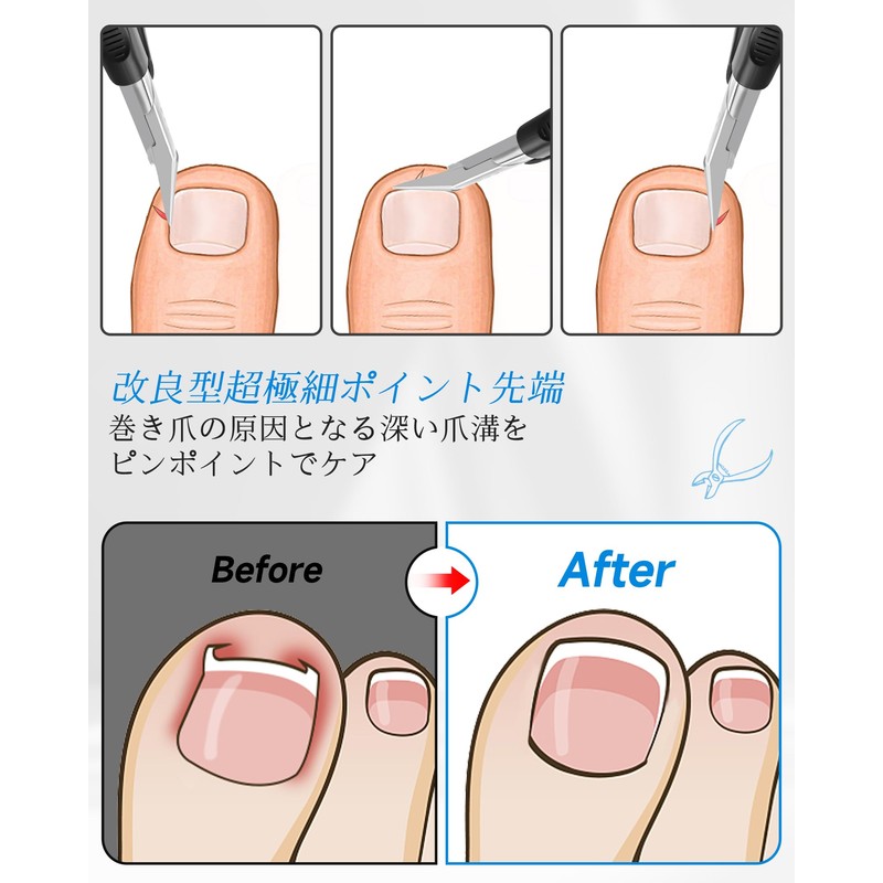 Tisojpod Nail Clipper, Nail Clipper, For Winding Nails, Double V-Shaped,