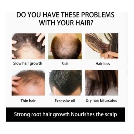 Dermaroller Barba Rodillo Facial Regenerador Aguja 0,5 Mm