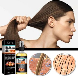 ROFPM Batana Oil Boost Hair Spray Hair Growth Oli, Prevents Hair Loss, Repairs Damaged Hair 4.3 Oz, Brown