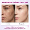 Crema Despigmentante Facial
