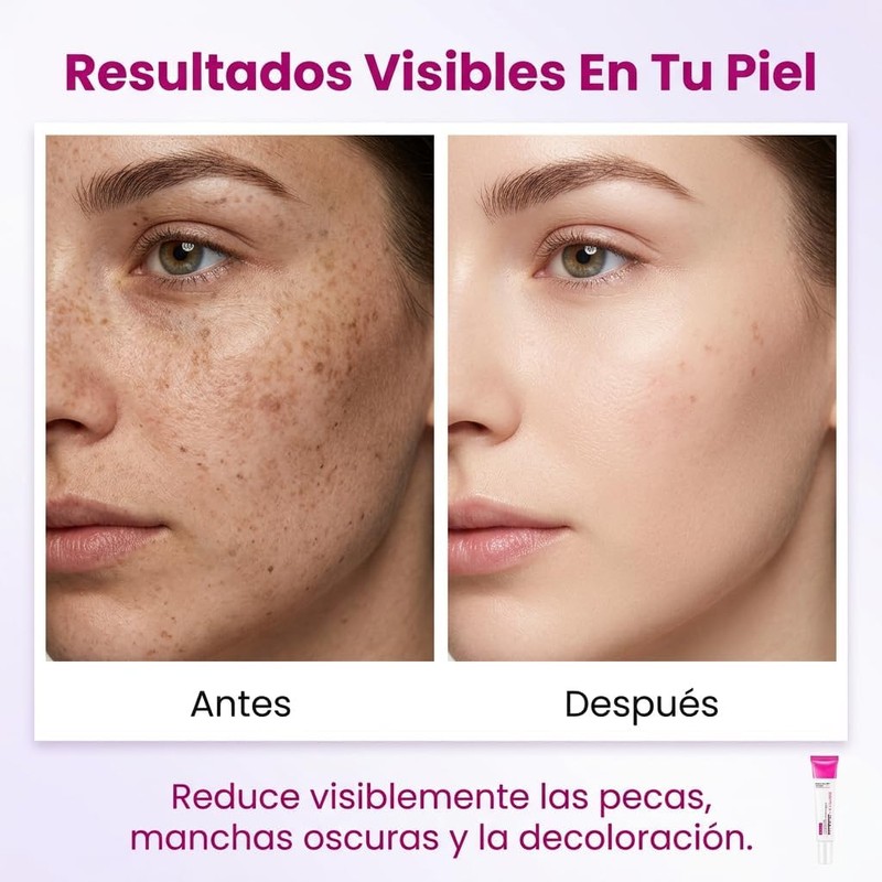 Crema Despigmentante Facial