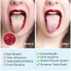 Limpiador Lingual Oral Raspador De Lengua Acero Inoxidable