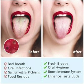 Limpiador Lingual Oral Raspador De Lengua Acero Inoxidable