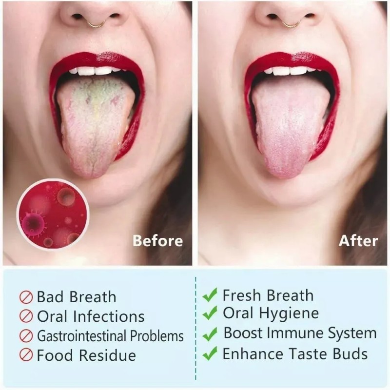 Limpiador Lingual Oral Raspador De Lengua Acero Inoxidable