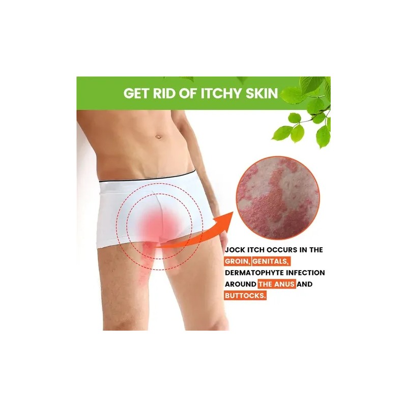 Pomada H Tinea Cruris 30g Crema Para Picazón En La