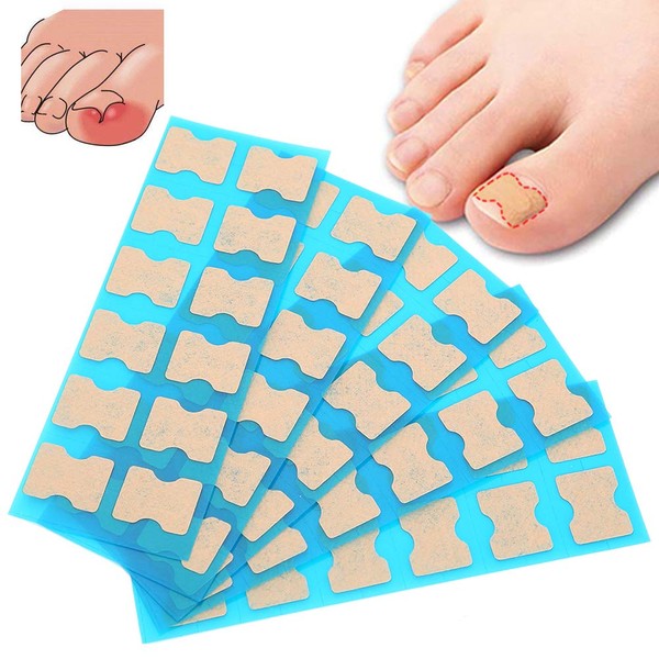 Ingrown Toenail Treatment Patches, 60 Pcs Paronychia Relief Toe Stick Toenail Corrector Strips Curved Toe Nail Brace Stickers Ingrowing Toenail Lifter Correction Strips, for Fungal Nails Care Tool