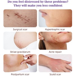 AICHUN BEAUTY Scars Repair Essence Lavender Extract Essential Oil Anti Scar Repair Cells Shiny Smooth Skin Care 30ml/1.01fl.oz