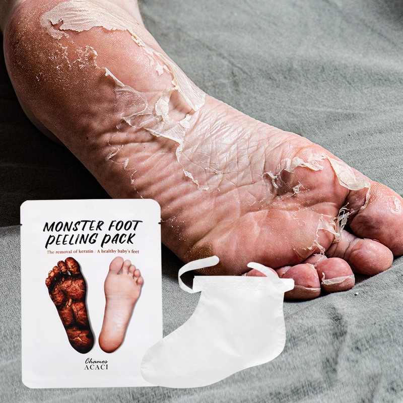 Daon Partner Company Exfoliation pack for power generation, Monster foot