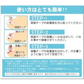 [Roll Claw Guide Stopper]