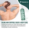 TreeActiv Salicylic Acid Back & Body Acne Spray, Back Acne