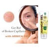 ARNICA FAST GEL 50 g for skin care with bru­ises