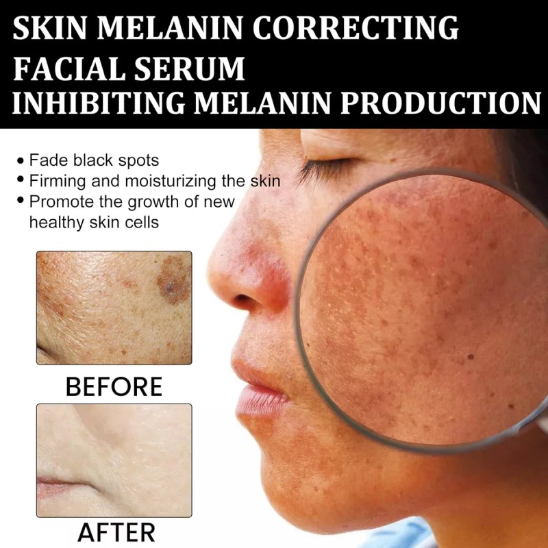 Deuiosna 2023 Corrección De Melanina Suero Facial, Sero De Cara
