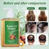2 Botellas Champú Batana, Crecimiento Del Cabello