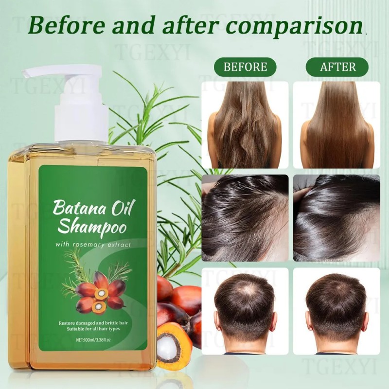 2 Botellas Champú Batana, Crecimiento Del Cabello