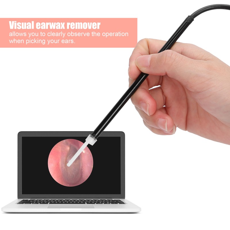3‑in‑1 Visual Earwax Remover Luminous Ear Endoscope Earwax Cleaning Removal