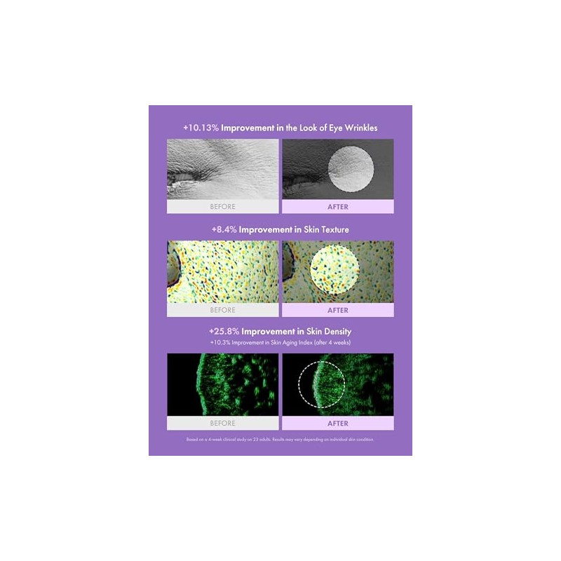 Maxclinic Exosome Pdrn - Ampolla Reparadora de Suero Facial Hidratante
