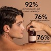 Apivita Shampoo Contra las Caspas Secas 250ML