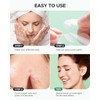 ZATKTK Acne Pimple Patch (180 Counts 4 Sizes), FSA Eligible
