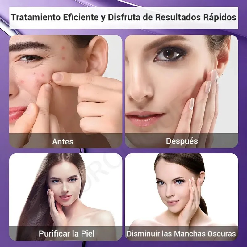 Sdfs A 2 Unidades Crema Acido Azelaico, Suero Acido Fgsfs