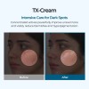 Crema Facial Despigmentante Y Anti Manchas Pack X2 Pa