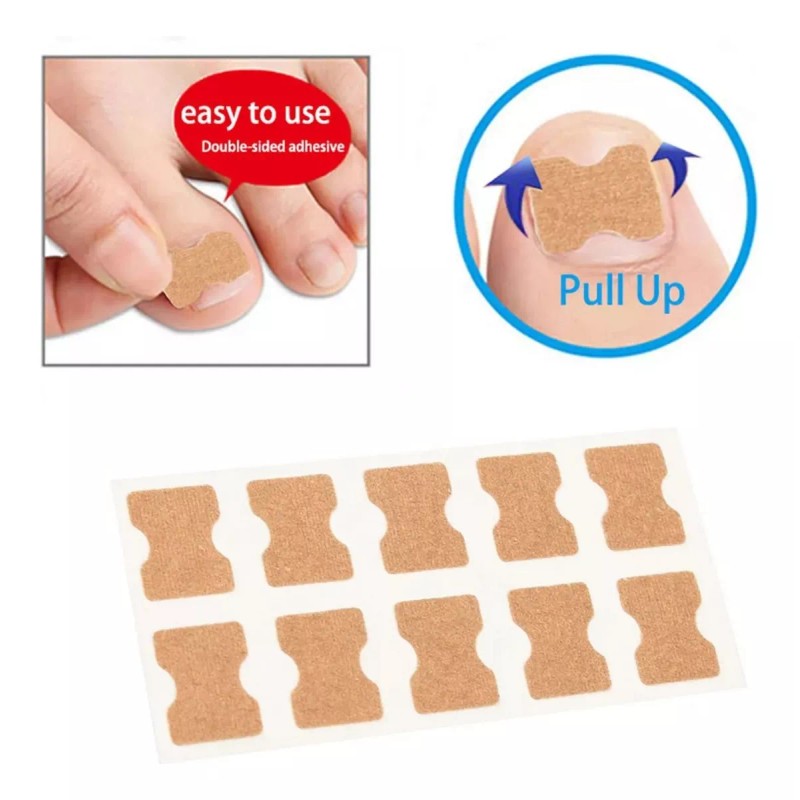 Universo en Linea 50 Parches Correctores Uñas Enterradas Uñeros Adhesivos