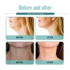 Crema\gel Tratamiento P Cuello Caido Gordo Papada Flacides
