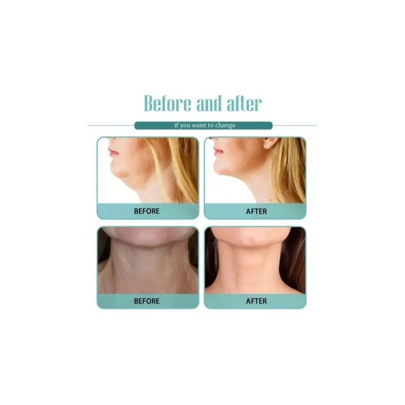 Crema\gel Tratamiento P Cuello Caido Gordo Papada Flacides