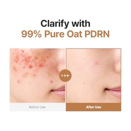 PURITO - Tónico Refinador Suave de Avena PDRN 200 mL 6.76 fl.oz, Tónico Exfoliante Coreano de Avena 99% Pura PDRN, Fórmula Hidratante y Clarificante para Piel Prone a Acné, Vegano, No Comedogénico