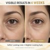 Daytime Eye Cream for Dark Circles & Puffiness, with Caffeine,