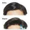 L'Oréal Professionnel |Scalp Advanced |Anti-sensibilidad